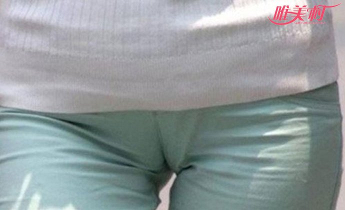 女性裆部凸起的东西是什么非常的尴尬
