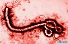埃博拉病毒会不会造成世界末日？
