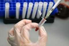 艾滋病疫苗难产为哪般？