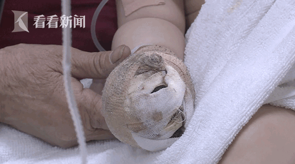 奶奶开取暖器出门引大火