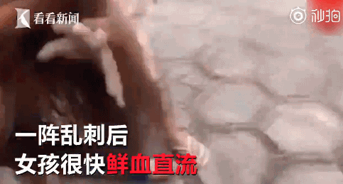 近日，巴西女子伊莱恩看见自己读初中的女儿与同学打架后不仅没有阻止，还建议女儿拿出口袋里藏着的锋利小刀往对方胸部刺去。视频显示，2名穿着蓝色运动服的初中女生正狂殴对方，双方都死死拽住对方的头发不肯放，伊莱恩不断鼓励女儿用刀刺对方：“朝她胸部捅过去！”女孩被刺后鲜血直流，伊莱恩担心弄出人命才出手把刀夺回来。被刺女生伤势严重，但幸好保住了性命。这对母女在事后藏了起来以躲避警方追捕。