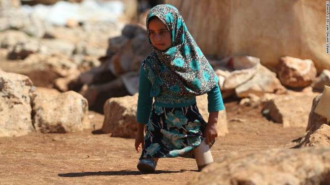 没钱装义肢，叙利亚8岁女童靠两个罐头走路（图）