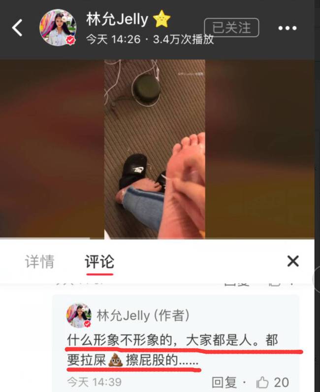 林允回应撕脚皮：大家都是人 都要拉屎擦屁股的