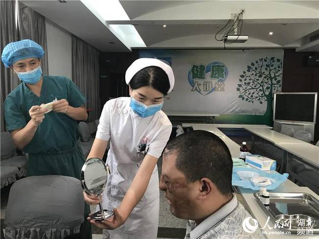 面部严重烧伤被遗弃 24岁小伙在武汉成功“换脸”【4】
