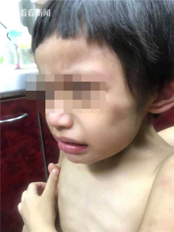 男童遭父亲虐待绑阳台：饿到抓粪便吃3.jpg