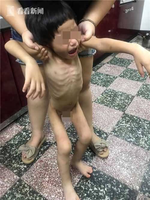 男童遭父亲虐待绑阳台：饿到抓粪便吃4.jpg