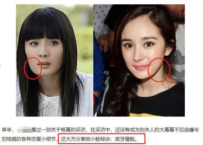 高晓松拔牙照引丁香医生科普，杨幂baby整容却反遭网友热议