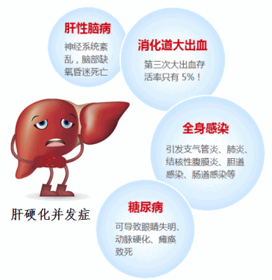 软肝术_河南哪所医院治肝硬化比较好