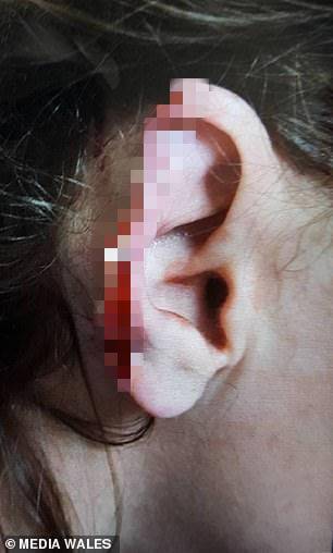 女子一言不合咬掉朋友耳朵被判4年半 法官:太残忍