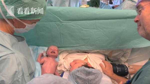 世界首例!不孕妇女接受死者子宫移植 诞下健康女婴