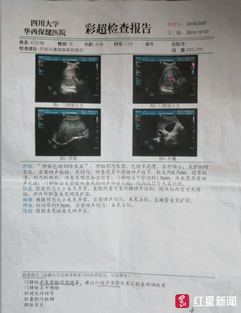 6岁男童住进ICU 肝癌父亲为省钱停掉自己的化疗