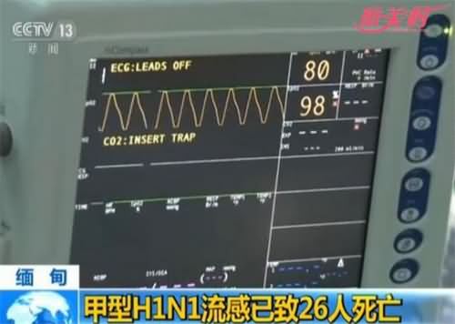 甲型流感致26人死