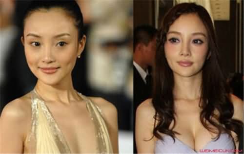 李小璐隆胸前后对比照 李小璐隆胸前后对比照