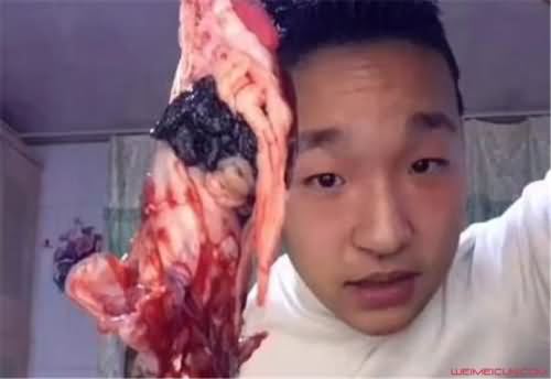 社会你胜哥手臂怎么回事