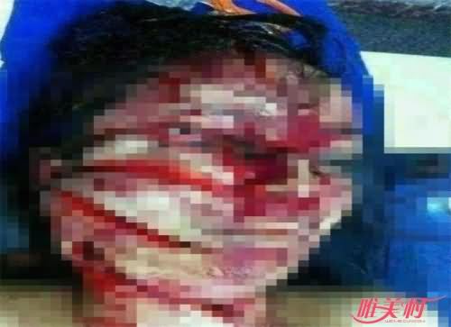 祁可欣被砍后遗照 祁可欣被砍后遗照