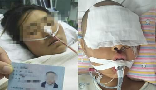 母女吃野蘑菇中毒
