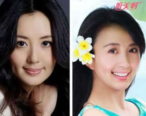 宋林静和杨童舒对比照 宋林静和杨童舒对比照