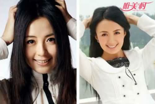 宋林静和杨童舒对比照 宋林静和杨童舒对比照