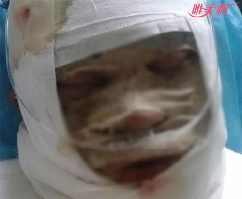 女子向男友泼热油