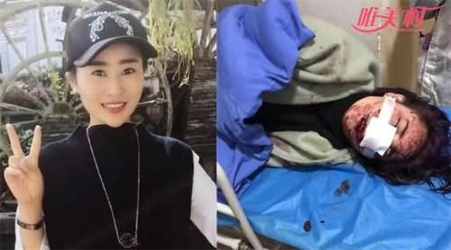 遭殴打的女游客