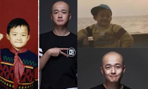 包贝尔为什么是光头