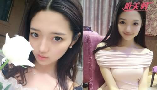 冰柠檬张兆艺,张兆艺堕胎,张兆艺男朋友,冰柠檬张兆艺堕胎过吗