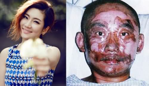 任家萱,任家萱烧伤,任家萱烧伤图片,任家萱结婚