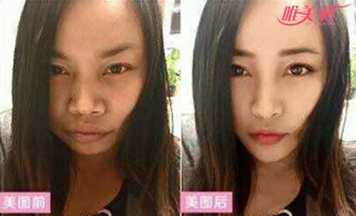 凤姐整容前后照片对比 凤姐自认身材很棒颜值蹭蹭往上窜