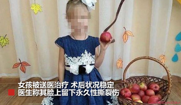 马戏团狮子咬女孩 马戏团狮子咬女孩