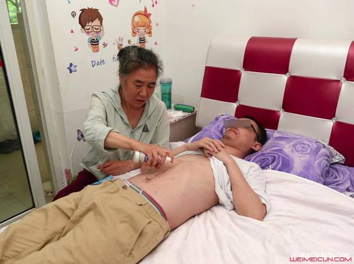 被撞摘右肾 被撞摘右肾