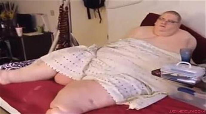 美国胖男29岁去世原因