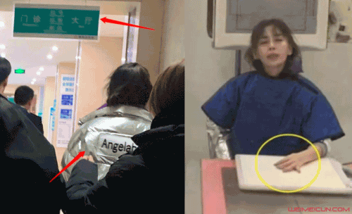 Baby就医被偶遇 Baby就医被偶遇