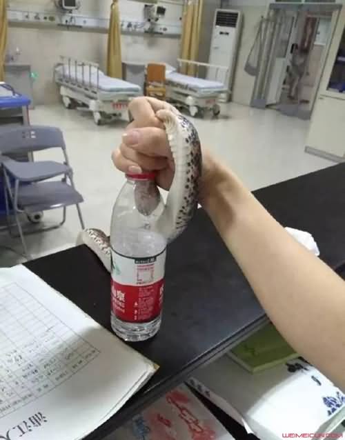 抓蛇看急诊 抓蛇看急诊