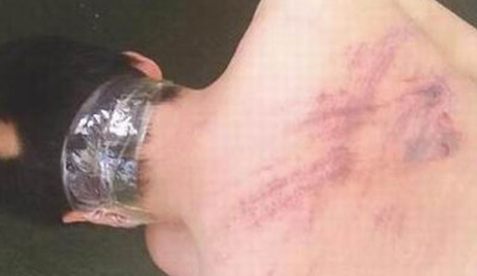 被骗缅甸免费游 被骗缅甸免费游