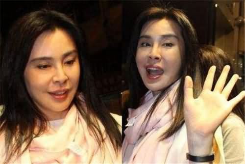 王祖贤怎么变丑了 整容失败一张脸肿成这样近看忒吓人