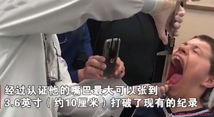 14岁男孩张嘴大破世界纪录