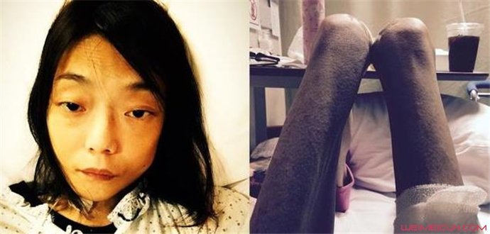 伍智恒生病之后照片 伍智恒生病之后照片