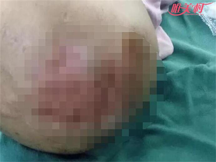 3岁女童伤痕累累