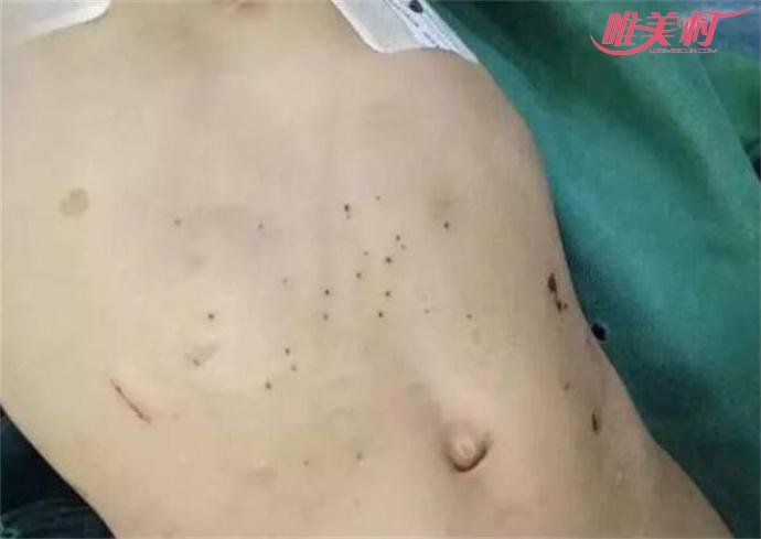 3岁女童身上布满大大小小的伤口