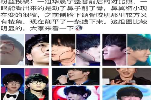 华晨宇整容前后照片 痕迹超明显网友为此吵翻天花花仍不回应