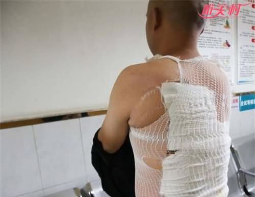 男子被店员泼开水
