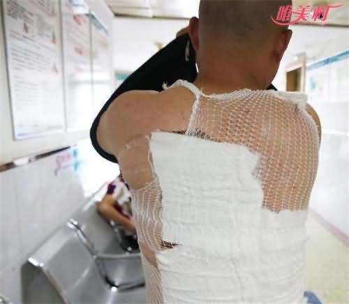 受伤男子杨先生
