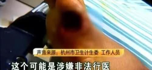 涉事修脚店或涉嫌非法行医
