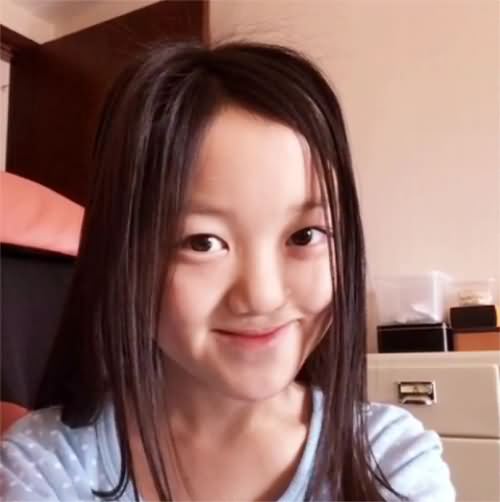 王菲女儿李嫣兔唇前后 王菲女儿李嫣兔唇前后