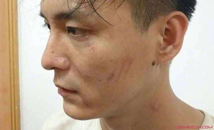 主播刘盾为什么被打 主播刘盾为什么被打