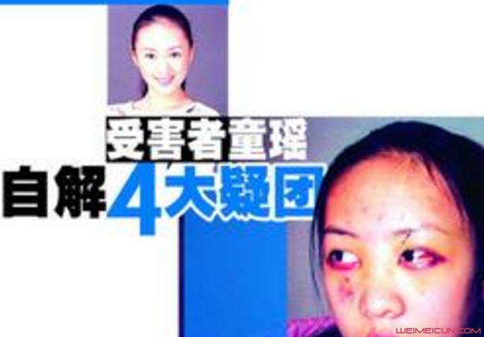 童瑶黄定宇事件怎么回事 童瑶黄定宇事件怎么回事