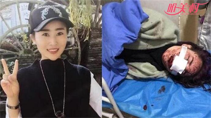 女游客丽江被打致毁容