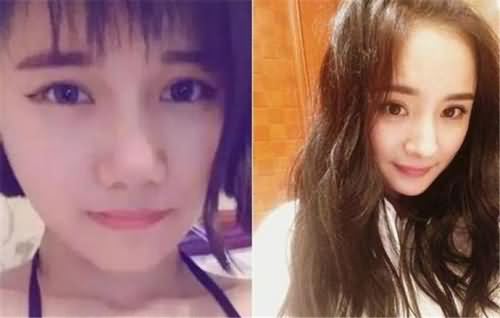 女生花百万整成杨幂 砸重金只为有甜美偶像范