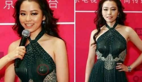 张靓颖,张靓颖乳钉,冯轲,张靓颖打乳钉 张靓颖,张靓颖乳钉,冯轲,张靓颖打乳钉