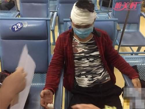 回家路惨遭三人围殴的小伙 回家路惨遭三人围殴的小伙